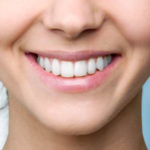 Sbiancamento dentale - terapia - Padova Dental Clinic.png