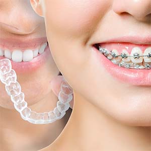 ortodonzia - terapia - Padova Dental Clinic